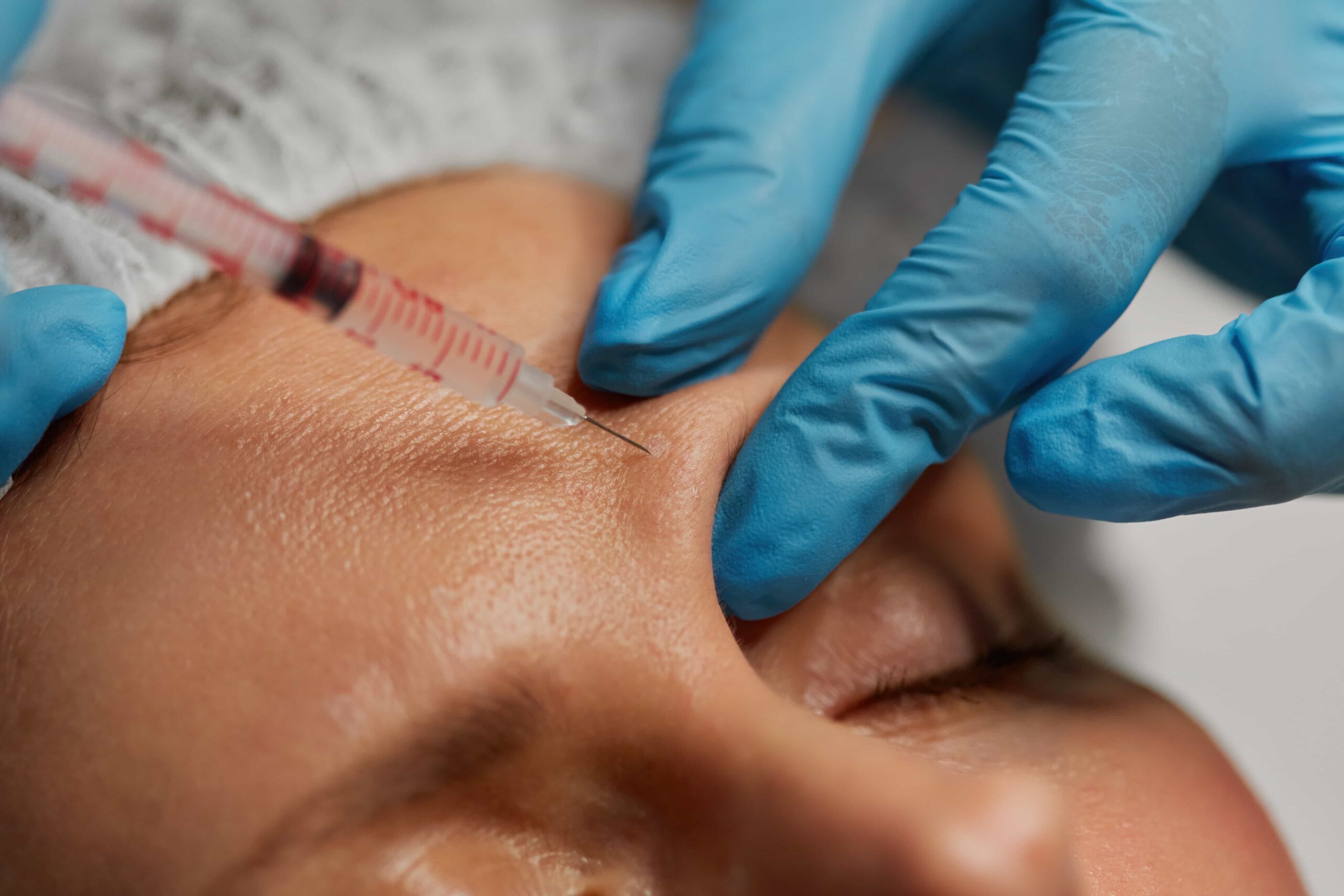 Mesotherapy