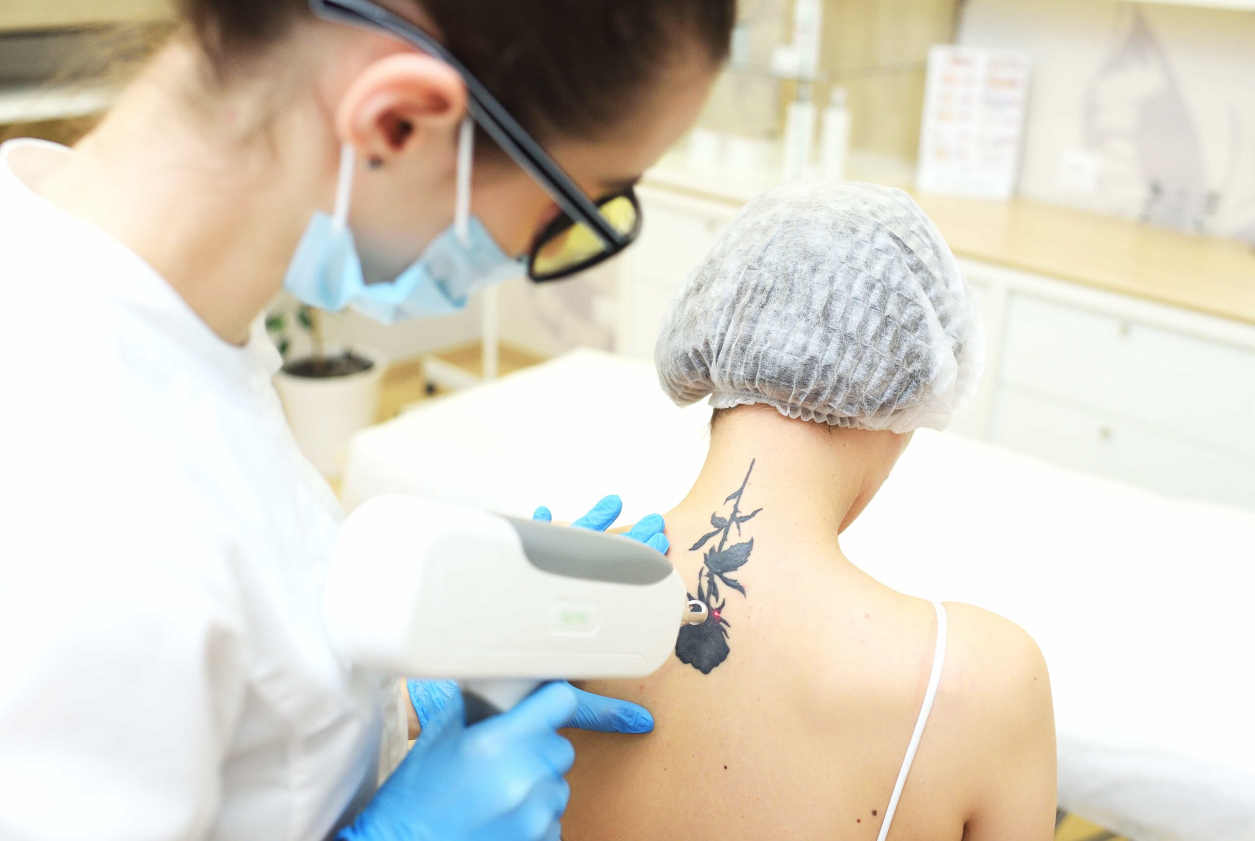 A professional in goggles and a face mask performing laser tattoo removal on a client's upper back, focusing on a black floral tattoo near the neck.