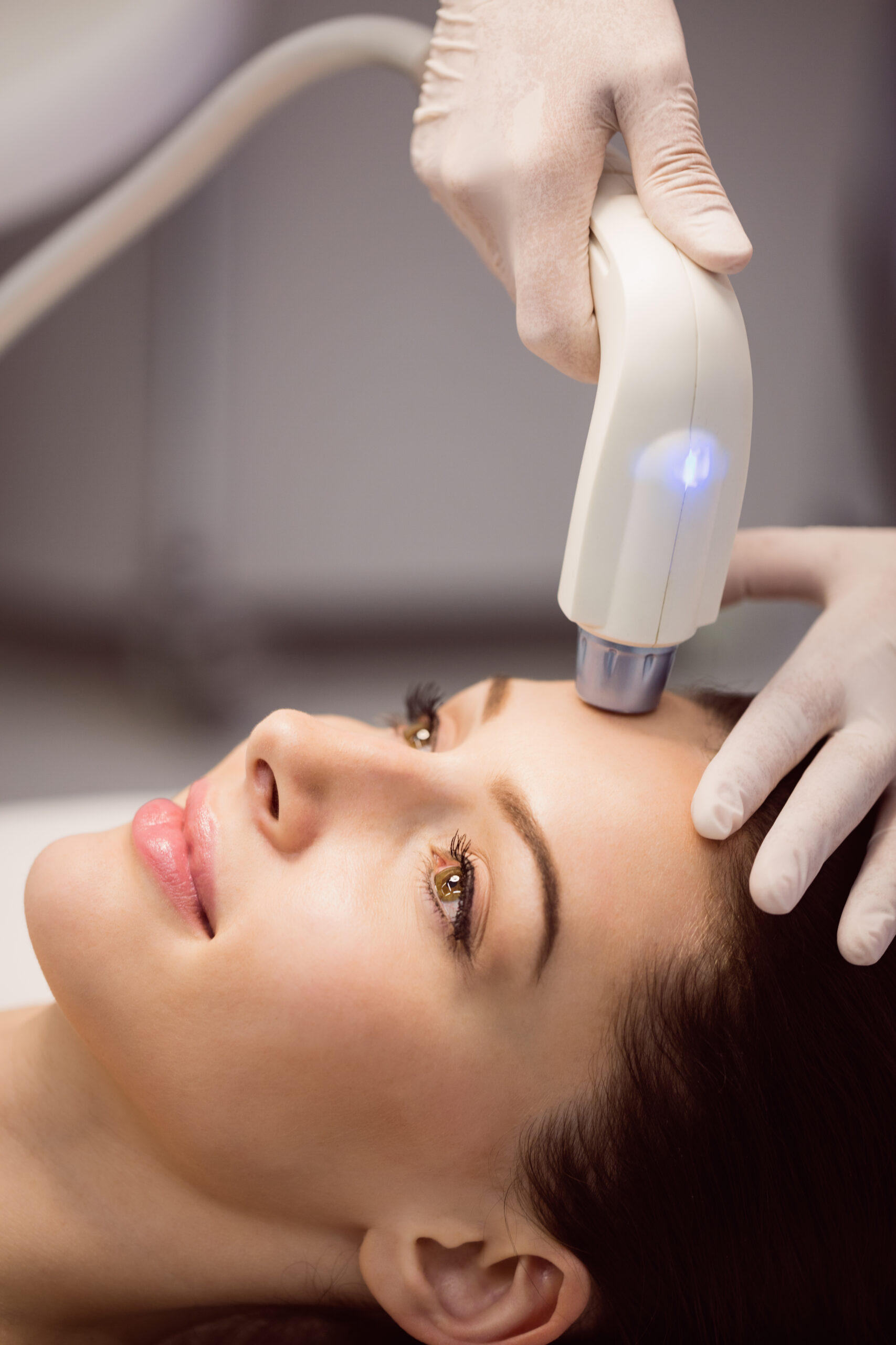 Laser hair removal treatment