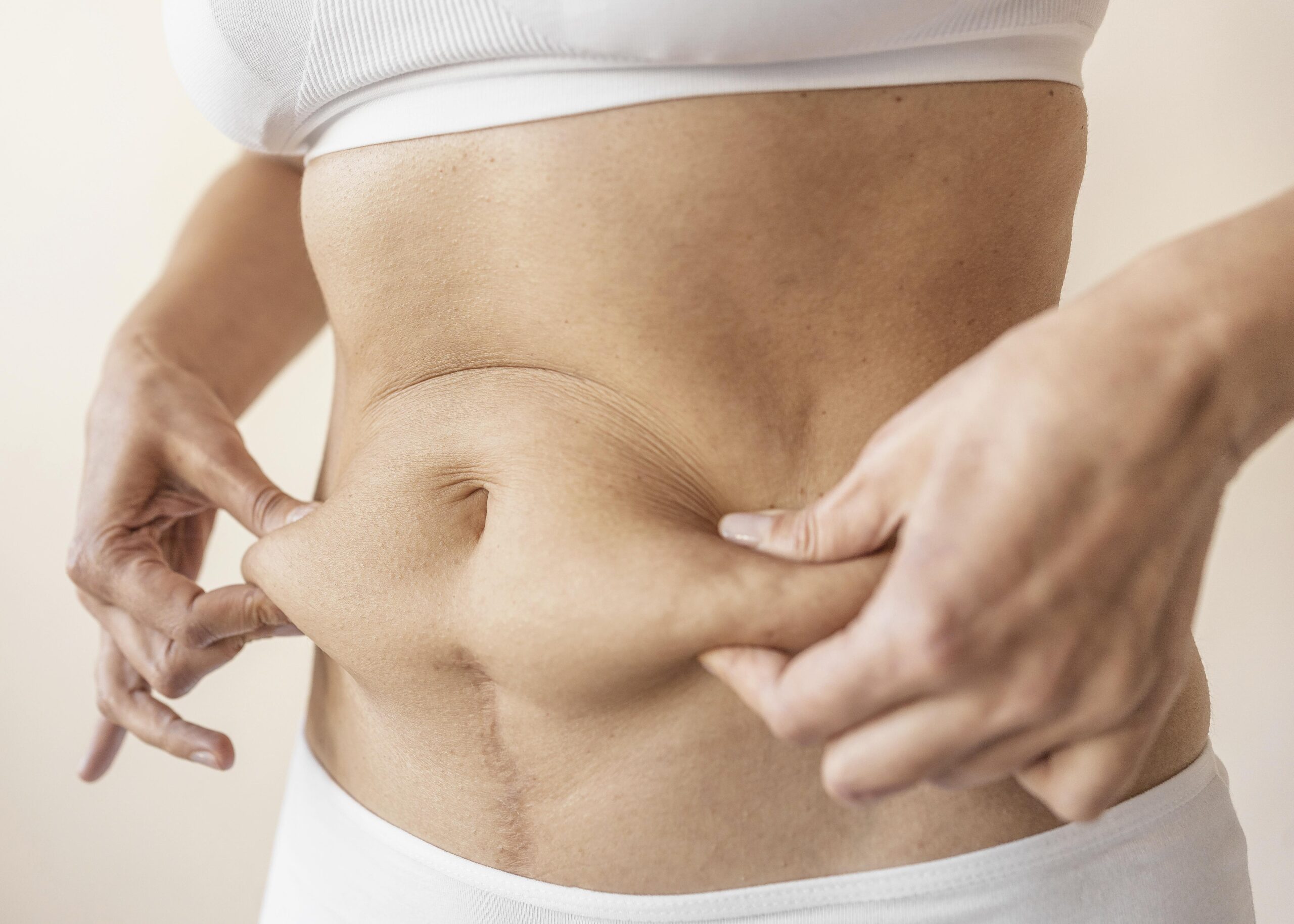 Lady holding belly and pinching cellulite
