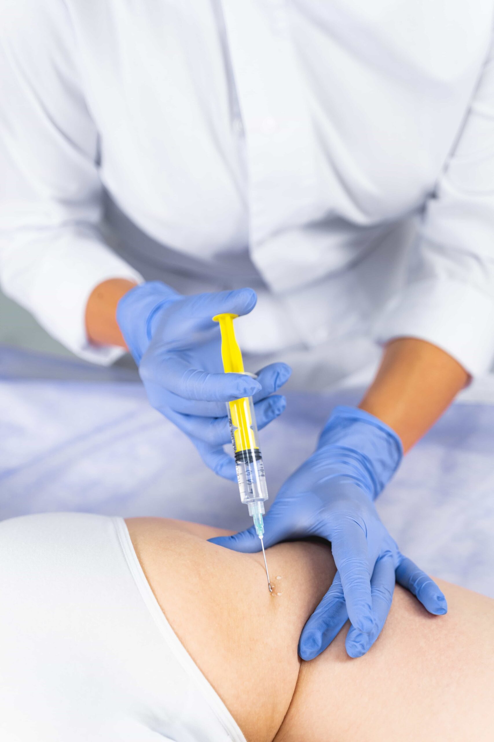 female patient getting rid of stretch marks