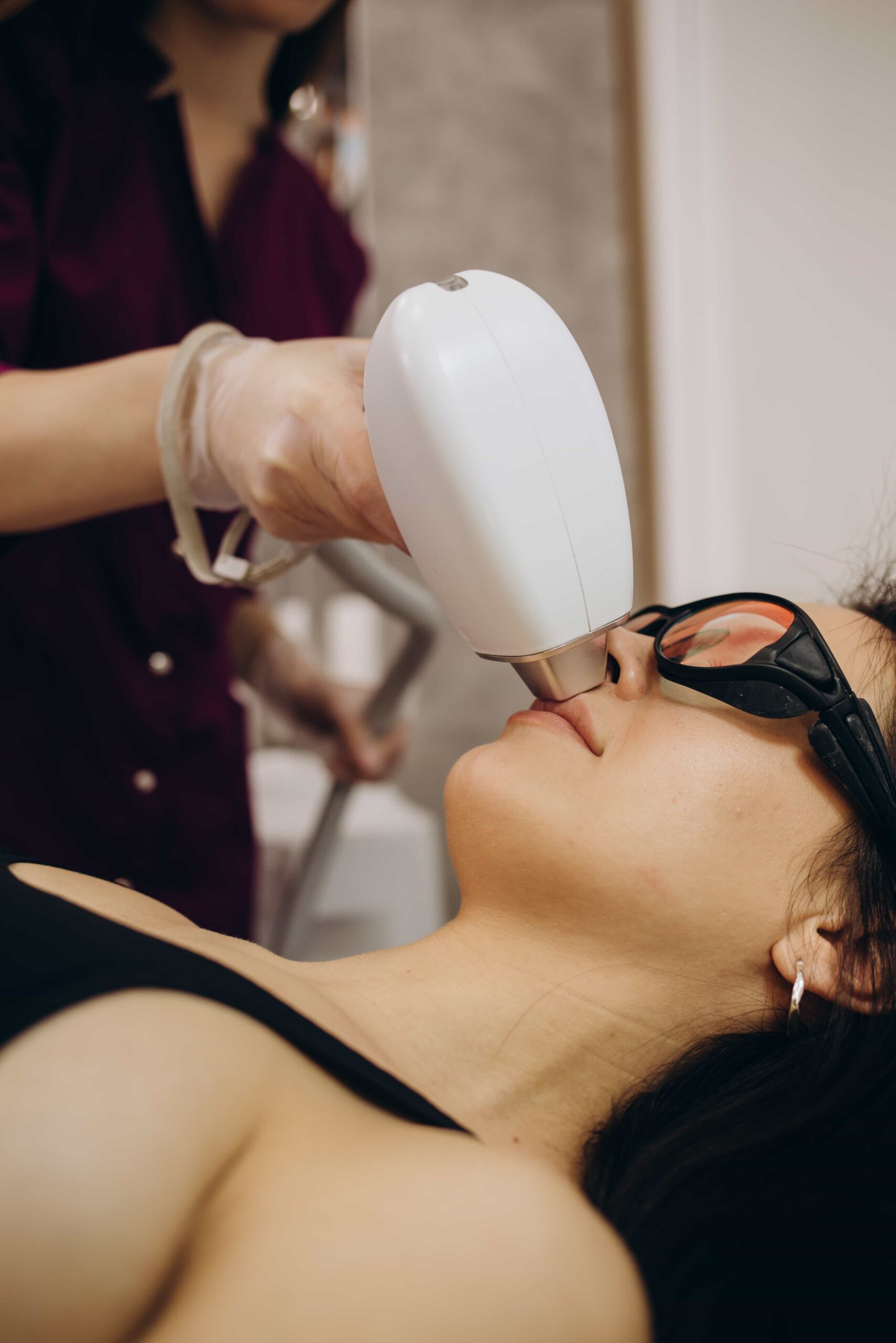 Laser hair removal treatment